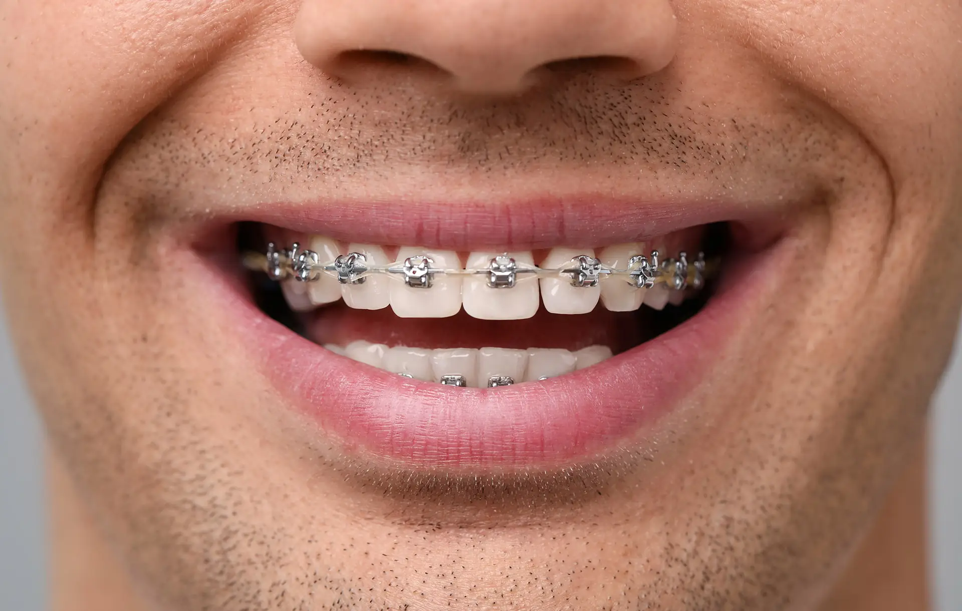 orthodontic-treatments