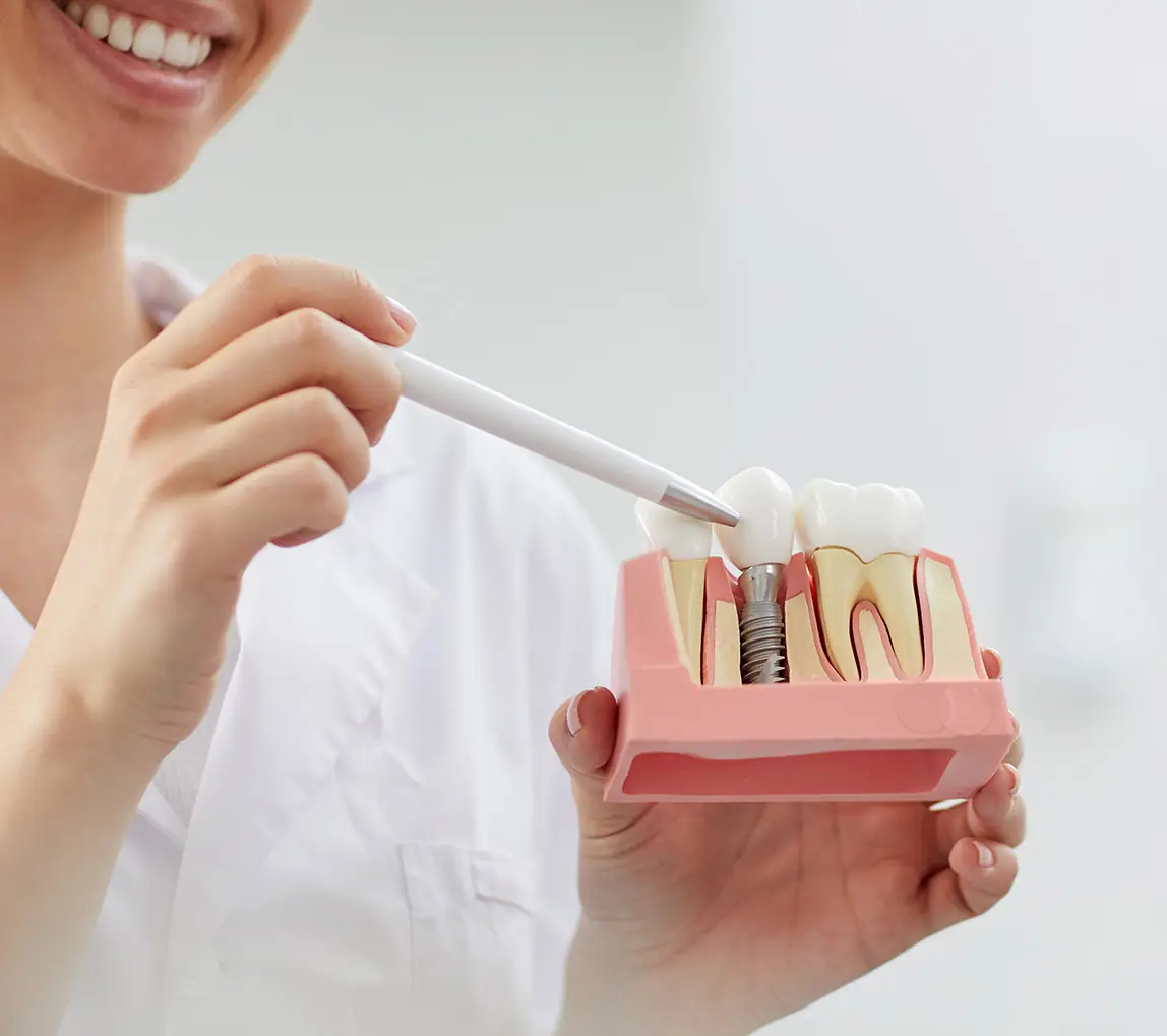 single dental implant