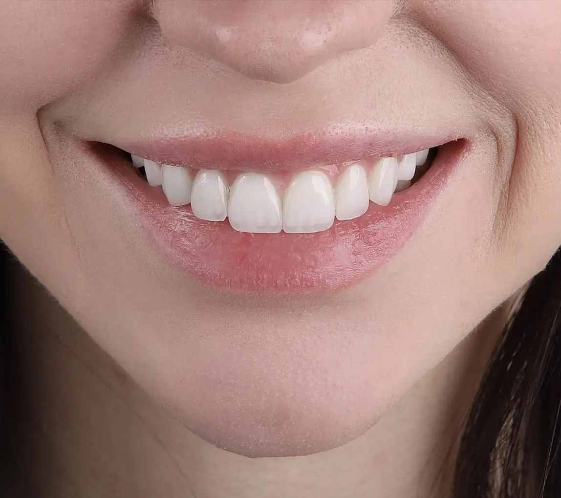 smile-makeover-clinic